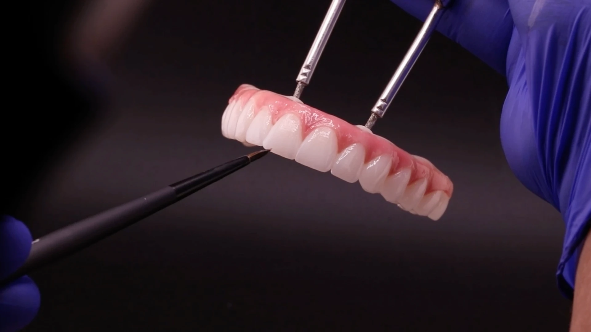 Ao4 Bridge Painting - All On Smile Dental Implants Vancouver WA