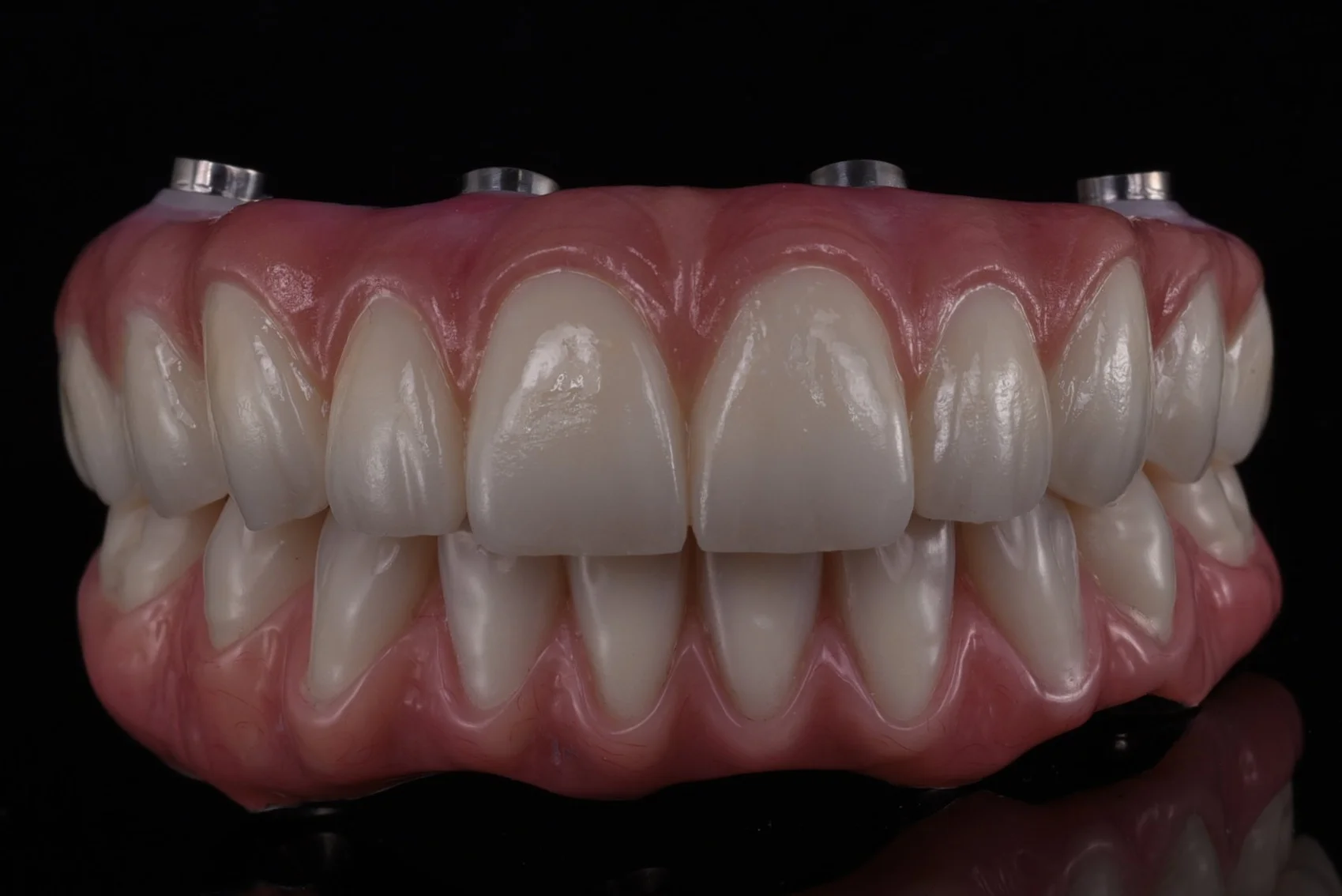 Aoxteeth - All On Smile Dental Implants Vancouver WA