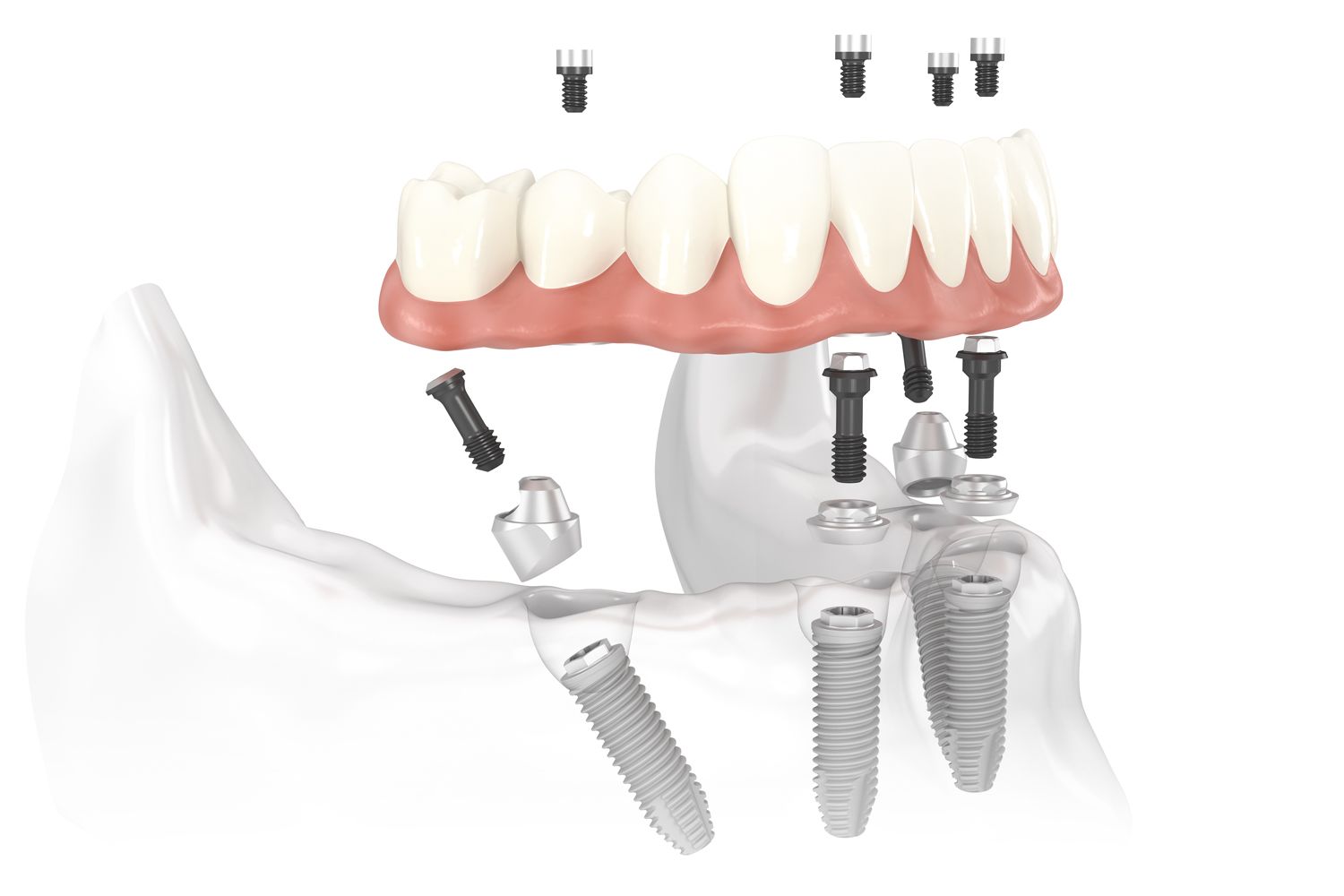 All On Smile Implant and Cosmetic Dentistry logo