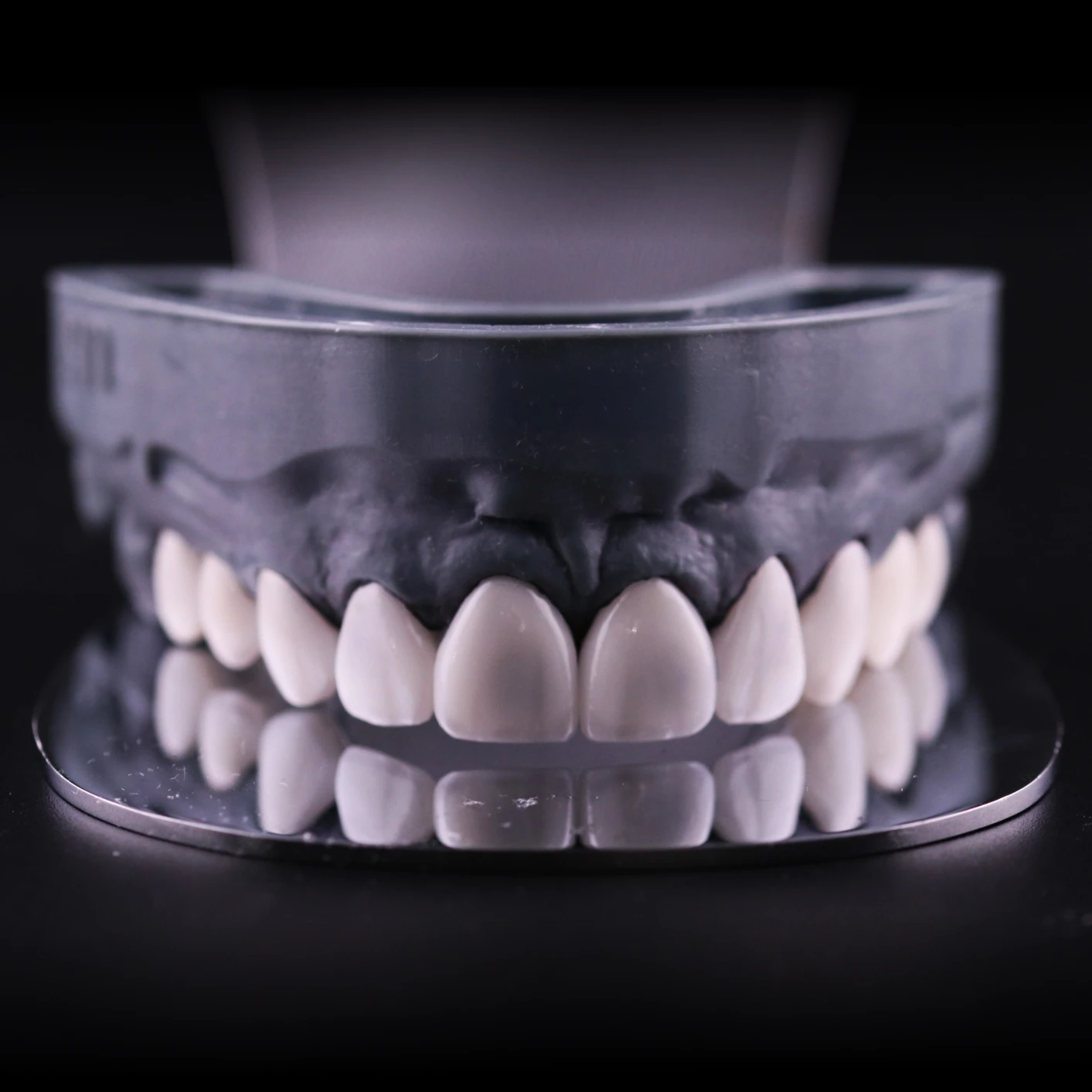 Veneers Model Square3 - All On Smile Dental Implants Vancouver WA